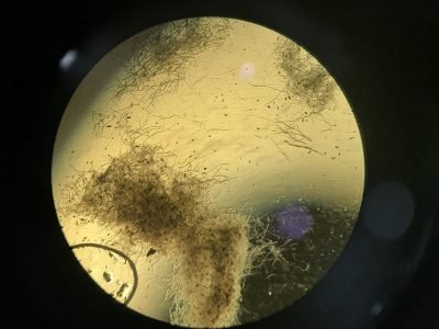 Foto: Cristina Tordin

Bactérias benéficas reduziram em cerca de 60% a severidade de doenças causadas pelo fungo Bipolaris sorokiniana. Na foto, placa de Petri usada na pesquisa