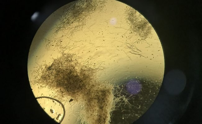 Foto: Cristina Tordin

Bactérias benéficas reduziram em cerca de 60% a severidade de doenças causadas pelo fungo Bipolaris sorokiniana. Na foto, placa de Petri usada na pesquisa